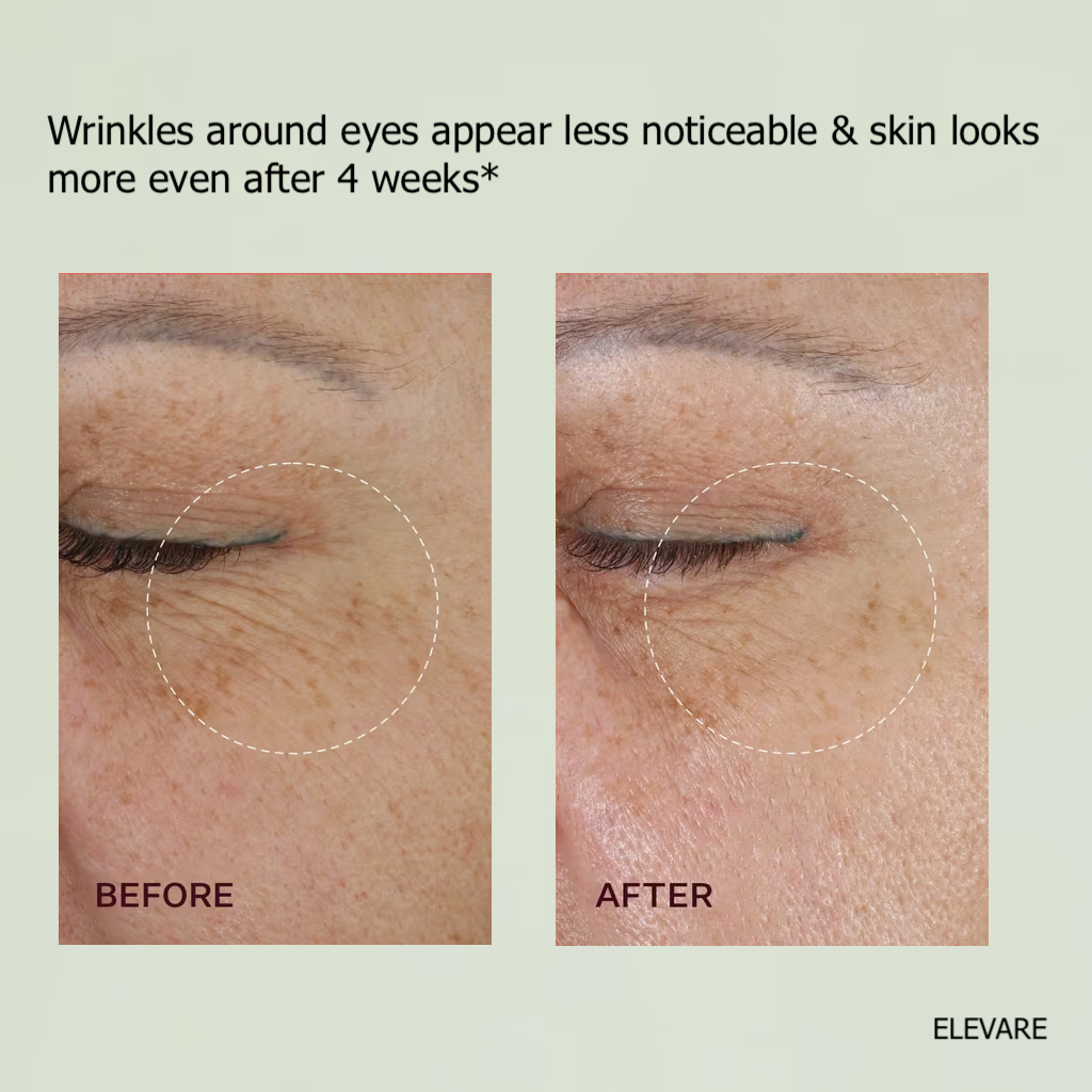 Korean Dark Spot Recovery Duo- PACK OF 2