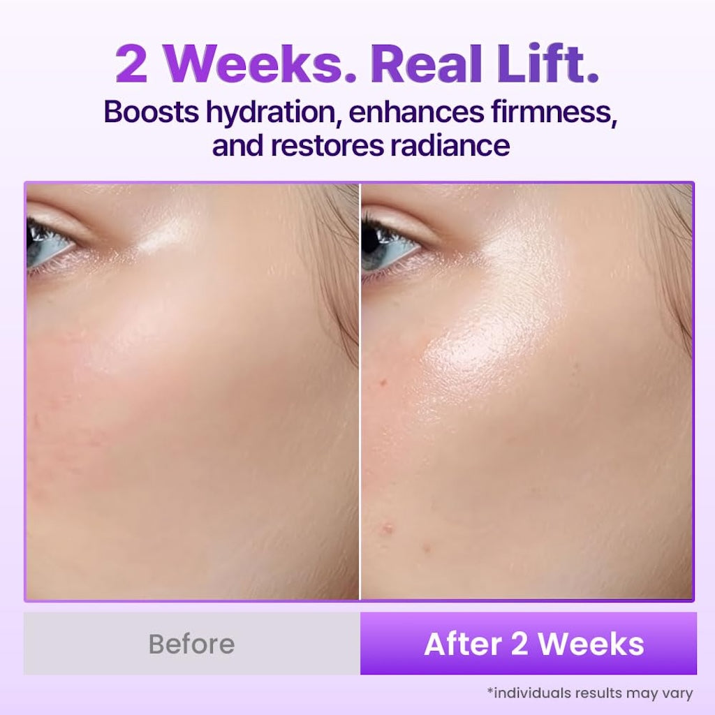 The 3D Lifting Protocol™