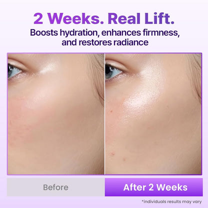 The 3D Lifting Protocol™