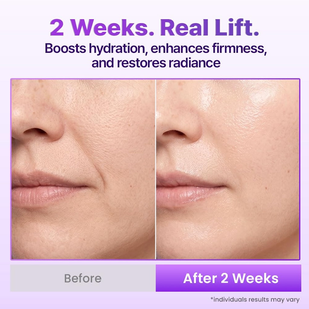 The 3D Lifting Protocol™