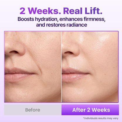 The 3D Lifting Protocol™