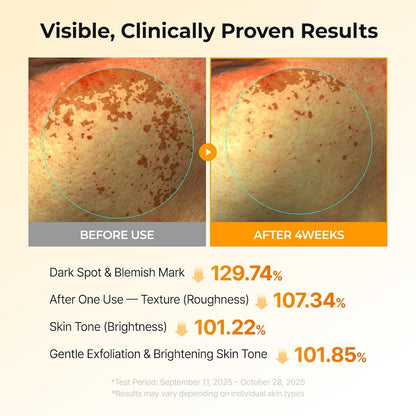 TX-Kojic Acid Turmeric Toner Pad