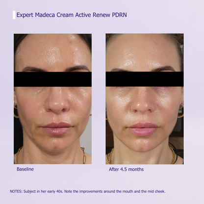 Expert Active Renew Cream